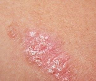 skin rashes contagious - MedHelp
